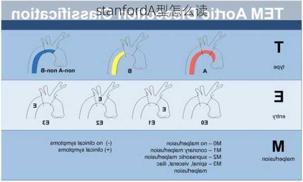 stanfordA型怎么读