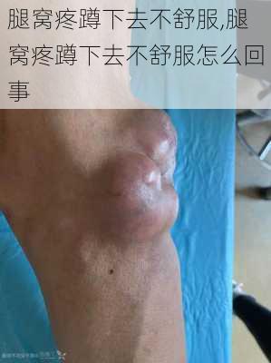 腿窝疼蹲下去不舒服,腿窝疼蹲下去不舒服怎么回事